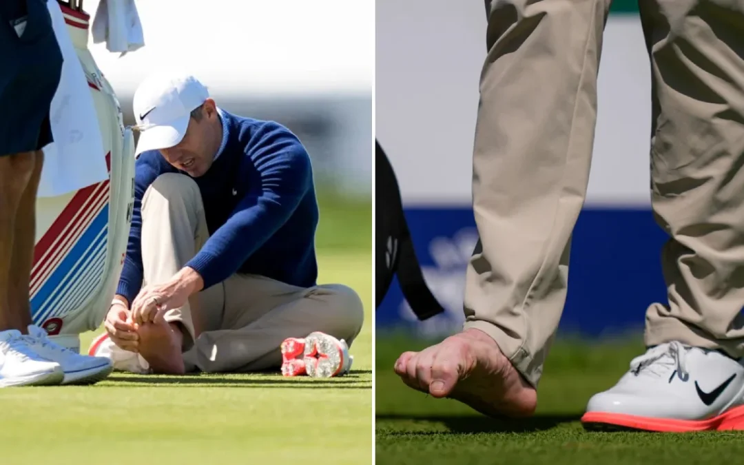 Lecet Kaki Ganggu Persiapan Rory McIlroy Jelang PGA Championship